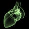 Heart X-Ray 2