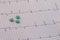 Heart waves recorded on paper called an electrocardiogram. Heart beat