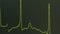 The heartbeat line on the monitor. Green is the color of the heart rate . Monitoring of the cardiogram signal.
