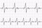 Heartbeats cardiogram. ECG heart line. Electrocardiogram paper background. Vector