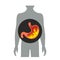 Heartburn in the stomach. flat vector illustration isolated
