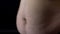 Heavy male with big fat belly close up, skin stretch marks, hormonal disorder