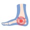 Heel pain icon cartoon vector. Arthritis joint