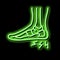 heel spur disease neon glow icon illustration