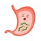 Helicobacter Pylori in the stomach. Sick stomach character. Bacterium with flagella that causes gastritis.