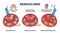 Hemoglobin as oxygen gas transportation mechanism in body outline diagram