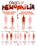 Hemophilia Causes Poster