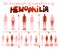 Hemophilia Infographics Image