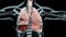 Hemopneumothorax, Normal lung versus collapsed, symptoms of Hemopneumothorax, pleural effusion