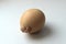 Hen egg with a defect built-up on the shell.The reasons are metabolic disorders of polyethological nature, lack of water