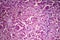 Hepatic congestion, light micrograph