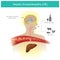 Hepatic Encephalopathy. Protein food or drinking