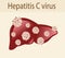 Hepatitis C virus attack the liver