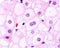 Hepatocyte. Nucleolus. Amitosis