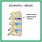 Hernia Schmorl. Intervertebral disc. Side view. Spine. Infographics Vector illustration on isolated background