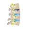 Hernia Schmorl. Intervertebral disc. Side view. Spine. Infographics Vector illustration on isolated background