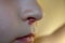 Herpes on the nose - Pretty young caucasian boy with herpes her on nose. Close-up. Human Virus