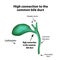 High connection to the common bile duct. Pathology of the gallbladder.