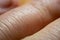 High-resolution image of human finger skin under macro closeup.