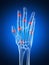 Highlighted arthritic hand