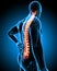 Highlighted back pain in male