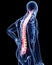 Highlighted back pain in male