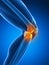 Highlighted knee joint