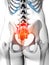 Highlighted sacrum