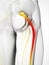 Highlighted sciatic nerve