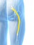 Highlighted sciatic nerve