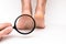 Highly dry heels woman on a white background closeup through a magnifying glass