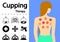 Hijama or Cupping Therapy Icons in flat vector art