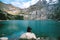 Hiker looking at view of Oeschinen Lake in the Swiss alps with beautiful turquoise water.