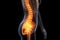 Hip joint pain, lumbar spine hernia, human body with osteoarthritis and scoliosis on a black background, health problems concept,