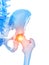the hip joint showing pain