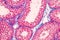 Histological Epididymis and Testis human cells under microscope.
