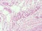 Histology of human adipose tissue