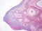 Histology of ovary human tissue