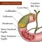 Ð¡holecystitis. Cholelithiasis.