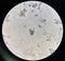 Hookworm egg human parasite in stool examination test