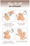 How to use a hand antiseptic to clean and disinfect hands. Vector illustration of Medical instruction