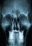 Human adult male skull x-ray image or radiography. Medical imagery