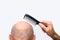 Human alopecia or hair loss - adult man hand holding comb