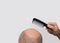 Human alopecia or hair loss - adult man hand holding comb