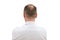 Human alopecia or hair loss - adult men bald head. back of balding man from shoulders isolated on white background