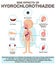 Human anatomy diagram cartoon style of hydrochlorothiazide side effects