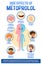 Human anatomy diagram cartoon style of metoprolol side effects