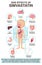 Human anatomy diagram cartoon style of simvastatin side effects