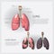 Human Anatomy Lung with Detail and Lung Cancer