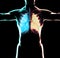 Human anatomy, problems with the respiratory system, severely damaged lungs. Bilateral pneumonia